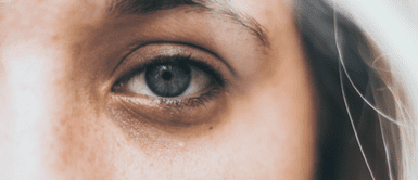 Ojeras. La poderosa planta con colágeno que borra las bolsas de los ojos para siempre, según expertos