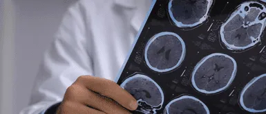 Alzheimer. Detectan el primer caso de Alzheimer en un joven de 19 años y expertos temen una nueva crisis de salud