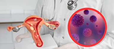 Virus del Papiloma Humano. ¿Cuáles son los síntomas del Virus de Papiloma Humano y cómo prevenirlo? Cuida tu salud