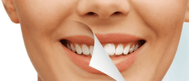 Dientes blancos. El secreto para una sonrisa radiante: agrega esto a tu pasta de dientes y blanquea tu sonrisa al instante