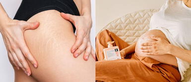 Estas son las cremas y aceites antiestrías más eficaz que hidratan y reparan Estas son las cremas y aceites antiestrías más eficaz que hidratan y reparan