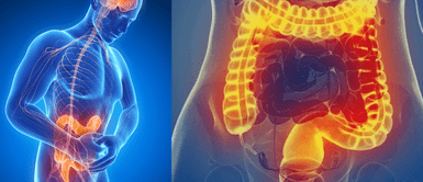 Intestino irritable y depresión. Impactante hallazgo: descubren un vínculo inesperado entre la depresión y el síndrome de intestino irritable