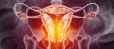 Cáncer de cuello uterino. 3 síntomas que toda mujer debe vigilar: podrían significar señales de cáncer de cuello uterino