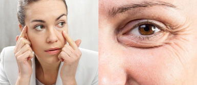 Tres hábitos muy efectivos que reducen las ojeras y las patas de gallo Tres hábitos muy efectivos que reducen las ojeras y las patas de gallo