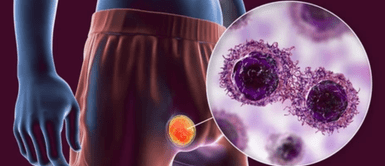 Cáncer de testículos. El nuevo cáncer genital que esta atacando a los jóvenes: ¿Estamos ante una epidemia silenciosa?