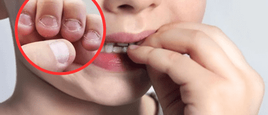 Por qué los niños se muerden las uñas. Qué significa que tu hijo se muerda las uñas y cómo evitarlo