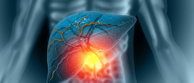 Hígado graso. El ejercicio clave para evitar el hígado graso y proteger tu salud, según expertos