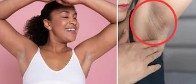 Más de 5 trucos naturales para blanquear tus axilas y olvidarte de las manchas Más de 5 trucos naturales para blanquear tus axilas y olvidarte de las manchas