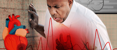 Síntomas de un infarto. Descubren síntomas de infarto que muchos ignoran y pueden ser fatales