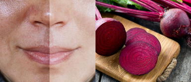 Betarraga milagrosa: tu nueva aliada para una piel uniforme y luminosa Betarraga milagrosa: tu nueva aliada para una piel uniforme y luminosa