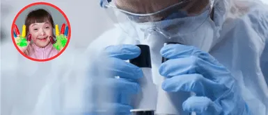 Síndrome de Down. ¿Posible cura? Científicos logran eliminar cromosoma extra que genera el síndrome de Down