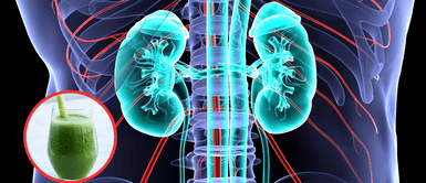 Consecuencias de tomar el jugo verde en exceso. El exceso de jugos verdes podría destrozar tus riñones sin que lo notes