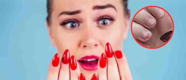 Usar uñas acrílicas puede ser riesgoso: esto es lo que debes saber Usar uñas acrílicas puede ser riesgoso: esto es lo que debes saber