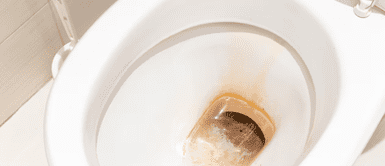Inodoro con sarro. Olvídate del vinagre y el bicarbonato: el truco secreto para eliminar el sarro del inodoro de una vez por todas