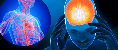 Migraña. Alimentos que NUNCA debes desayunar si tienes migraña