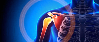 Dolor de hombro. Señales de alerta: estos malos hábitos y enfermedades están detrás del dolor de hombro