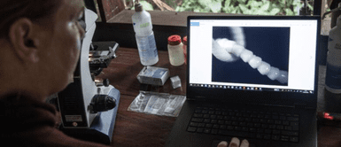 Parásitos en el cerebro. Fue al médico por un ardor en los pies y descubrieron algo escalofriante en su cerebro