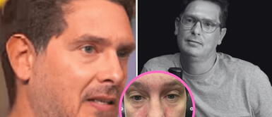 El conductor revela fuerte mensaje sobre su salud. Cristian Rivero enfrenta problema de salud con extraña reacción en su rostro