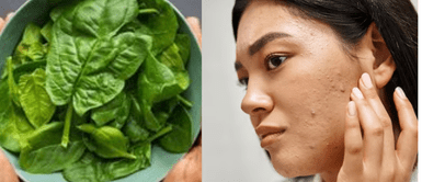 Espinaca, la clave oculta en la dieta de las modelos para una piel luminosa Espinaca, la clave oculta en la dieta de las modelos para una piel luminosa