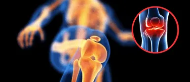 Huesos sanos. Olvídate del calcio: este mineral poco conocido fortalece tus huesos aún más, y probablemente ya lo tienes en casa