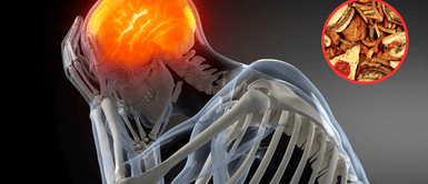 Alimentos que dañan tu salud cerebral. ¡Cuidado con lo que comes! Los alimentos que son malos para la memoria y debe evitar para cuidar el cerebro