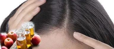 ¿Qué efecto tiene el vinagre de manzana en el cuero cabelludo? ¿Te aplicas vinagre en la cabeza? beneficios y riesgos que debes conocer