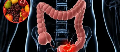 Cáncer de Colón. Esta FRUTA de verano podría ayudarte a prevenir el cáncer de colon, según expertos