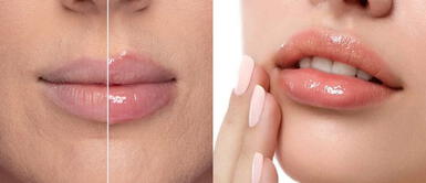 Los 7 voluminizadores de labios con efecto ácido hialurónico para labios más llenos Los 7 voluminizadores de labios con efecto ácido hialurónico para labios más llenos