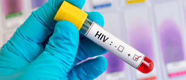 VIH. Más de 8 mil casos de VIH en Perú reavivan el miedo a una epidemia: ¿debemos preocuparnos?