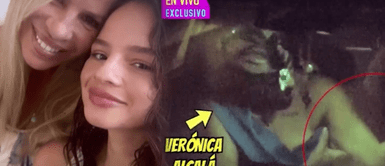 Verónica Alcalá muestra lesiones tras ser agredida por su hija Thamara Medina Mamá de Alejandra Baigorria muestra marcas de la salvaje agresión que sufrió de su hija Thamara Medina