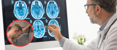 Alzheimer: el extraño síntoma que puede revelarse mientras te duchas, según expertos Alzheimer: el extraño síntoma que puede revelarse mientras te duchas, según expertos