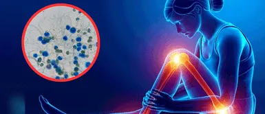 La silenciosa amenaza podría cambiar la salud global: hongos resistentes avanzan sin control La silenciosa amenaza podría cambiar la salud global: hongos resistentes avanzan sin control