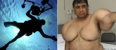 El dramático caso del buzo peruano que quedó “inflado” tras accidente en el mar hace 11 años. El dramático caso del buzo peruano que quedó “inflado” tras accidente en el mar hace 11 años