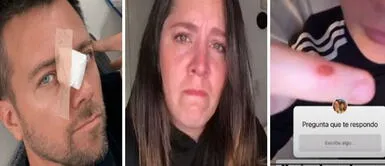 Yidda Eslava asombra al aparecer con HERIDAS y CORTES tras insólitas fotos de Julián Zucchi sangrando Yidda Eslava asombra al aparecer con heridas y cortes tras insólitas fotos de Julián Zucchi sangrando