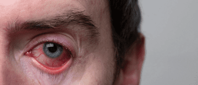 ¡No más vista cansada! Estas 3 vitaminas salvan tu salud visual, según expertos ¡No más vista cansada! Estas 3 vitaminas salvan tu salud visual, según expertos