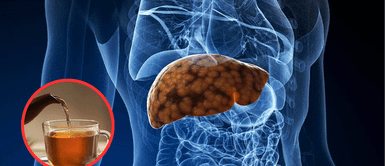 ¡Adiós al hígado graso! La infusión natural que lo limpia con solo un vaso al día ¡Adiós al hígado graso! La infusión natural que lo limpia con solo un vaso al día