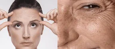 Tips casero para eliminar las líneas de expresión Elimina líneas de expresión con esta crema casera de linaza y romero