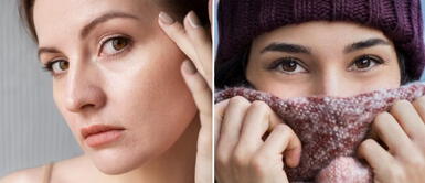 Mascarillas caseras para piel reseca invierno Mascarillas caseras para nutrir tu piel seca y protegerla del clima frío