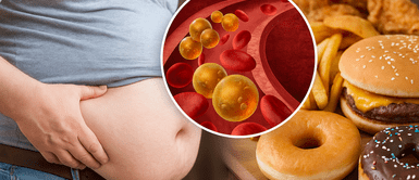 ¡Alerta en tu cuerpo! 3 señales claras de triglicéridos altos y cómo reducirlos ¡Alerta en tu cuerpo! 3 señales claras de triglicéridos altos y cómo reducirlos