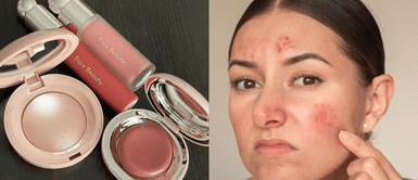 Rubor y rosácea ¿Tienes rosácea? Así puedes usar rubor sin empeorar la rojez, según expertos