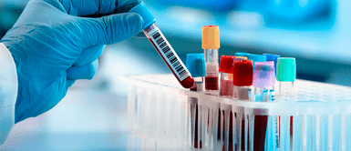 Esta es la enfermedad rara y de difícil diagnóstico afecta a cientos de peruanos Esta es la enfermedad rara y de difícil diagnóstico afecta a cientos de peruanos: Ellos son los más propensos