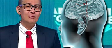 Toma en cuenta estos síntomas. Aneurisma cerebral con hidrocefalia: la grave enfermedad que enfrentó Erick Osores