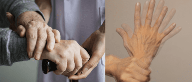 Alimentos que aumentar el riesgo de Parkinson, según Harvard ¡ALERTA! Estos alimentos comunes podrían aumentar el riesgo de Parkinson silenciosamente, según Harvard