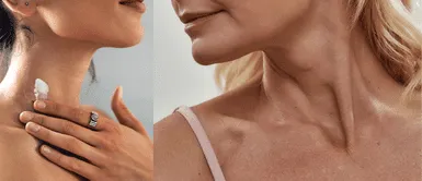 7 cremas que rejuvenecen cuello y escote Adiós flacidez: descubre las 7 cremas TOP que rejuvenecen tu cuello y escote al instante