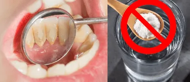 Truco para elimina el sarro en los dientes ¡Ni vinagre ni bicarbonato! Este truco indispensable elimina el sarro y deja tus dientes más blancos