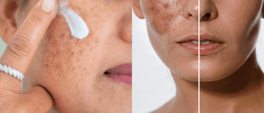 Cremas antimanchas para el rostro ¡Adiós manchas! Las 10 cremas faciales más recomendadas y efectivas del 2025