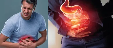 cánceres gastrointestinales ¡ALERTA MÉDICA! Casos de cáncer gastrointestinal se disparan en jóvenes menores de 50, ¿estás en riesgo?