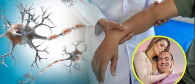 Rafael Fernández, ex pareja de Karla Tarazona, lucha contra el síndrome de Guillain-Barré. Rafael Fernández, ex de Karla Tarazona, enfrenta el síndrome de Guillain-Barré: especialistas explican los síntomas más graves