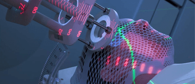 ¡Avance médico! Tratamiento con luz ofrece nueva esperanza a pacientes con Alzheimer ¡Avance médico! Tratamiento con luz ofrece nueva esperanza a pacientes con Alzheimer