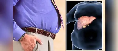 Hígado graso: Planta medicinal ¿Hígado graso? La planta milenaria que ayuda a regenerar el hígado y reducir la inflamación